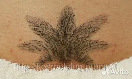 zhenskaya-strizhka-v-intimnom-meste zhenskaya-strizhka-v-intimnom-meste